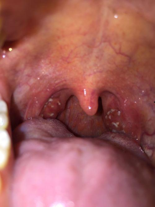 吃瓜喉咙哑了呛到