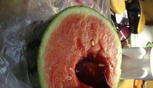 吃瓜吃进医院  第3张